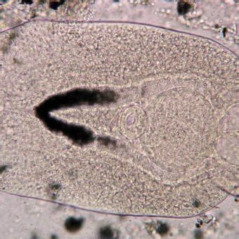  Diplostomum! A Tiny Trematode That Makes Fish See Double